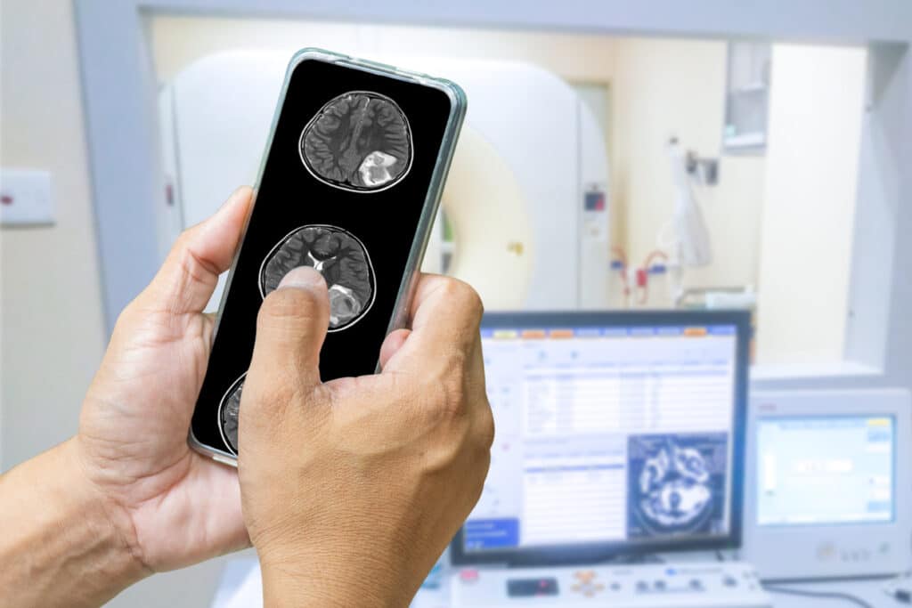 The Future of Radiology Imaging: Going CD-Free